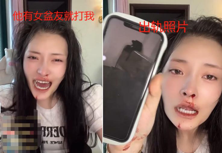 美女网红大琳遭家暴！鼻子被打歪全程嘶吼