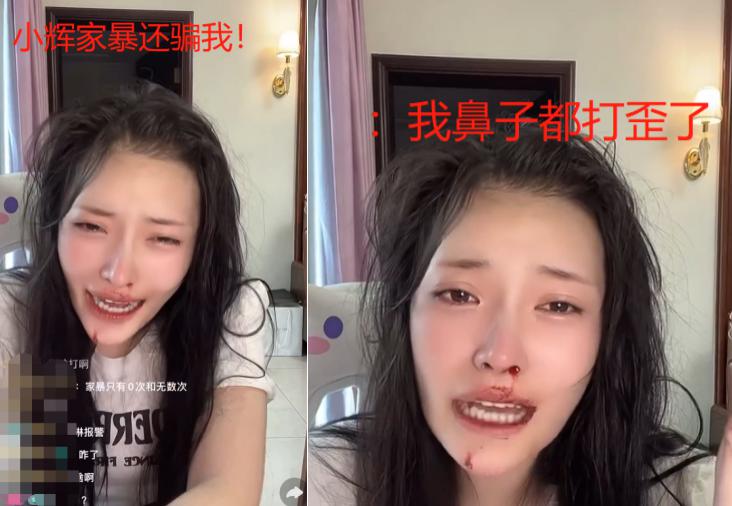 美女网红大琳遭家暴！鼻子被打歪全程嘶吼