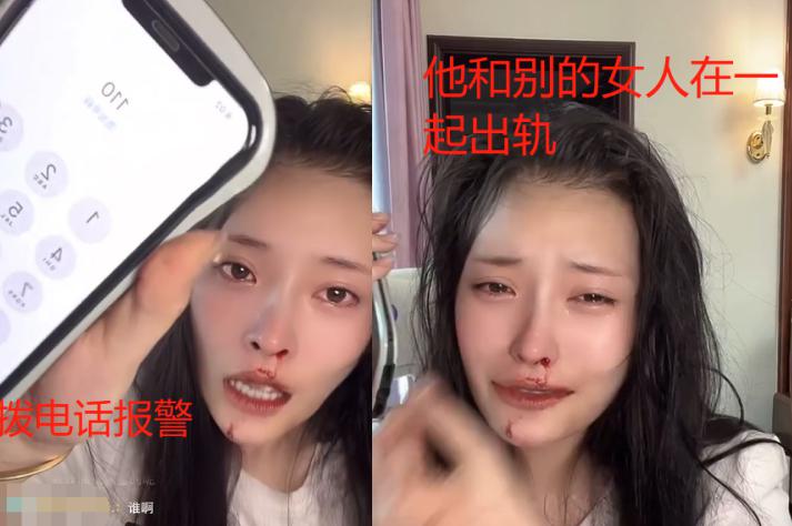 美女网红大琳遭家暴！鼻子被打歪全程嘶吼